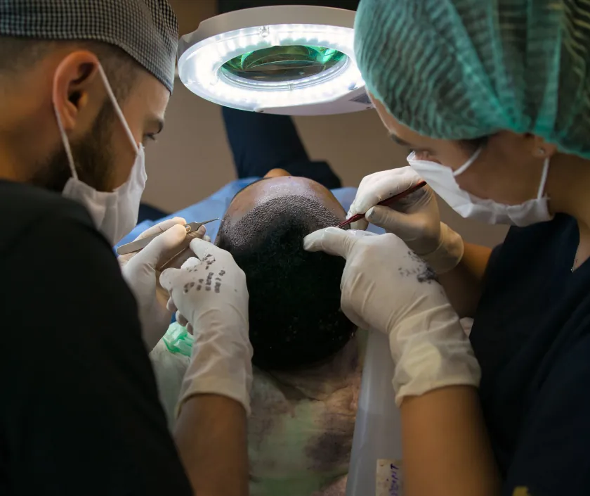 Hair transplant and male cosmetic surgery in Surat